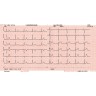 Электрокардиограф Fukuda CardiMax FX-8222 (6-канальный)